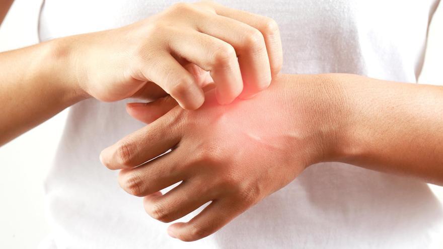 Adiós a rascarse la piel: el truco infalible para calmar los picores, según una dermatóloga