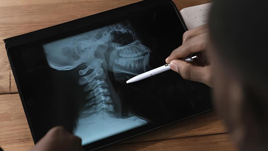 Inteligencia artificial: Mejora la predicción del cáncer de cabeza y cuello gracias a la IA