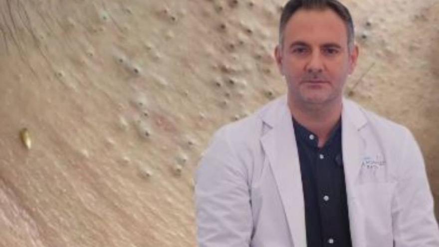 Adiós puntos negros: qué productos usar para tener un rostro perfecto, según un dermatólogo