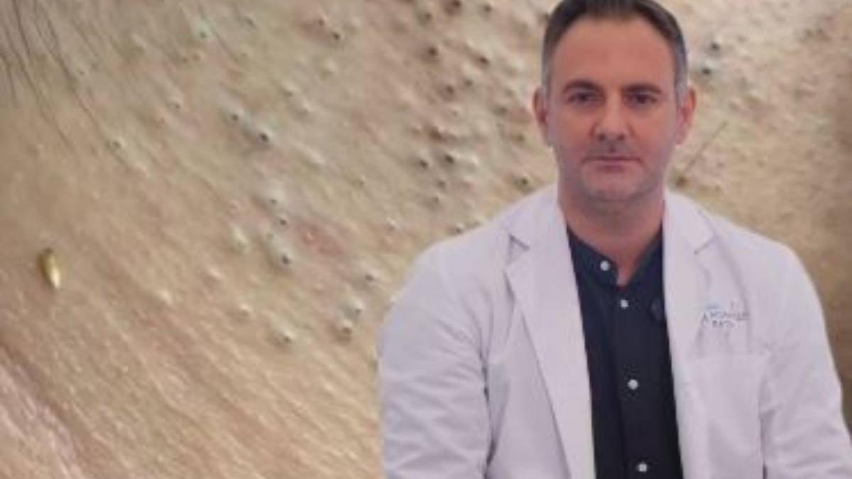 El dermatólogo Carlos Morales