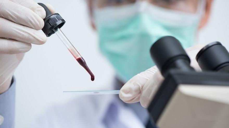 El hipotiroidismo se detecta con un análisis de sangre