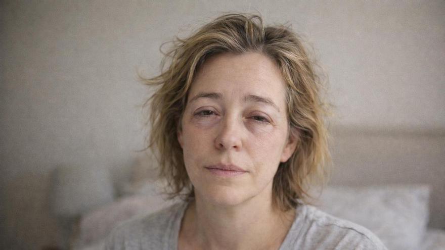 ¿Te levantas con los ojos hinchados?: una dermatóloga te lo explica