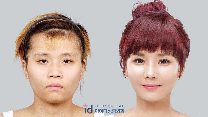 Fotos del antes y el después de Bae So-young, la joven de aspecto masculino transformada en &quot;princesa&quot; a golpe de bisturí.