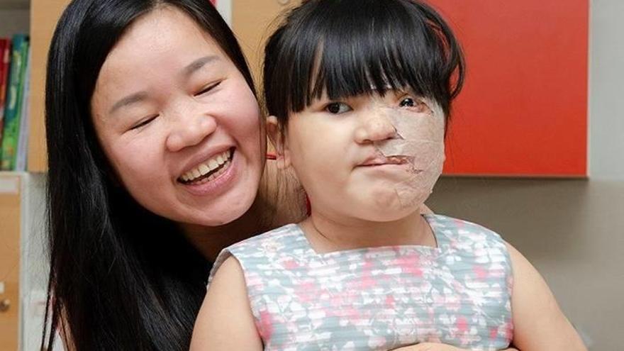 . La pequeña de cinco años ha contado con la ayuda Patti Maxey de Alabama, en Estados Unidos, que tras ver la situación de la pequeña en una foto de unos amigos que había hecho turismo en Vietnam emprendió una campaña para conseguir el dinero suficiente p