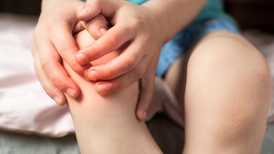 Dermatomiositis juvenil, la enfermedad rara que debuta en la edad pediátrica