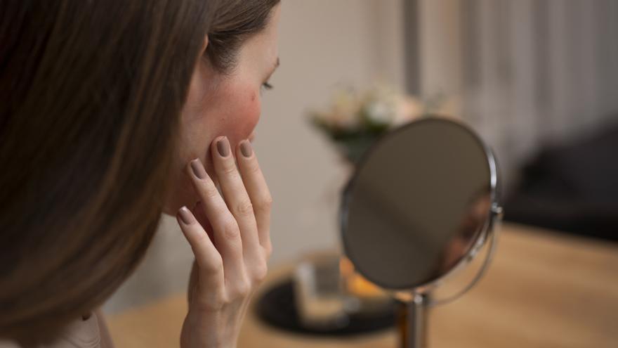 Rosácea en verano: por qué tu piel empeora incluso sin exponerte al sol