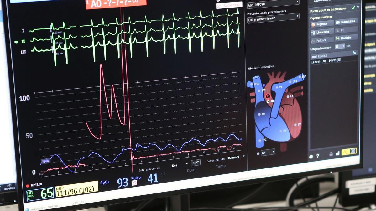 El HUN estrena nueva sala de Hemodinámica y zona de Cirugía Mayor Ambulatoria de Cardiología