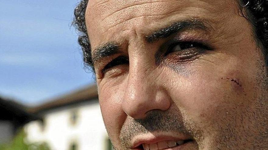 &quot;He tenido la mejor mala suerte&quot;