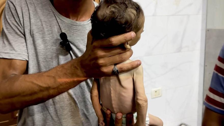 Los bebés no logran sobrevivir a la hambruna y al asedio israelí en Gaza