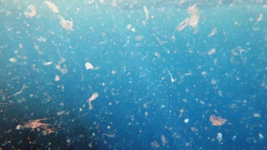 Los microplásticos pueden acumularse en la bilis humana como un reservorio oculto