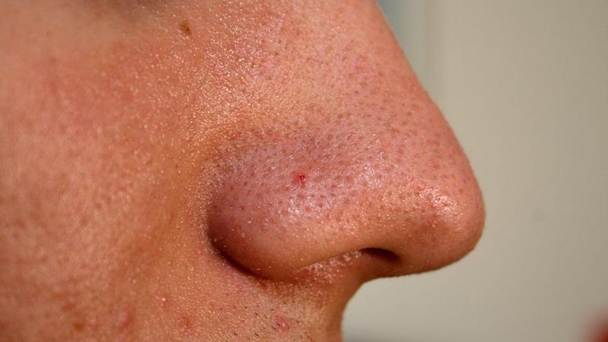 Adiós a los puntos negros: trucos sencillos para lucir un rostro más limpio y radiante