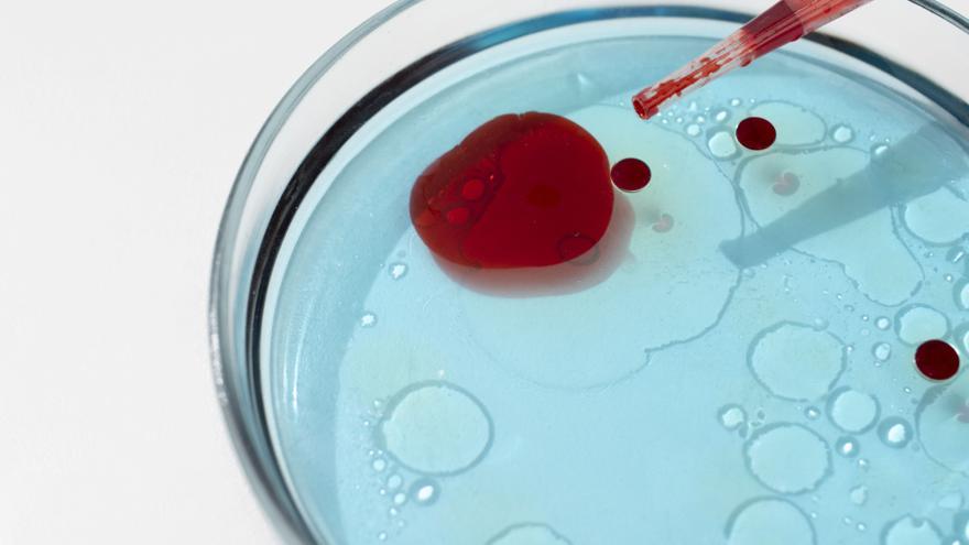 La anemia: una enfermedad prevenible, tratable y superable