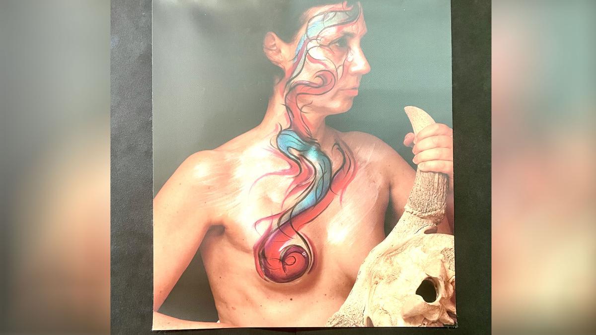La exposición muestra las cicatrices de 5 mujeres que han sufrido la enfermedad.