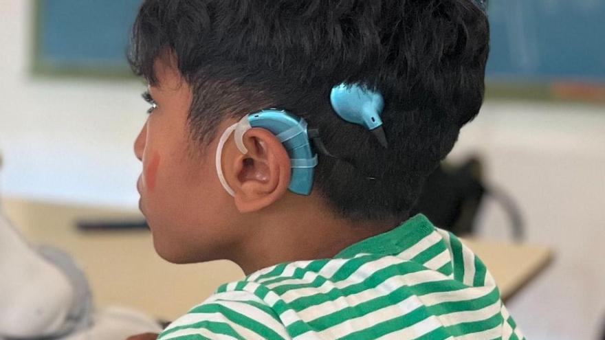 Un padre pide ayuda desesperada para recuperar el implante coclear robado a su hijo en la playa: &quot;Sin él no puede oír&quot;